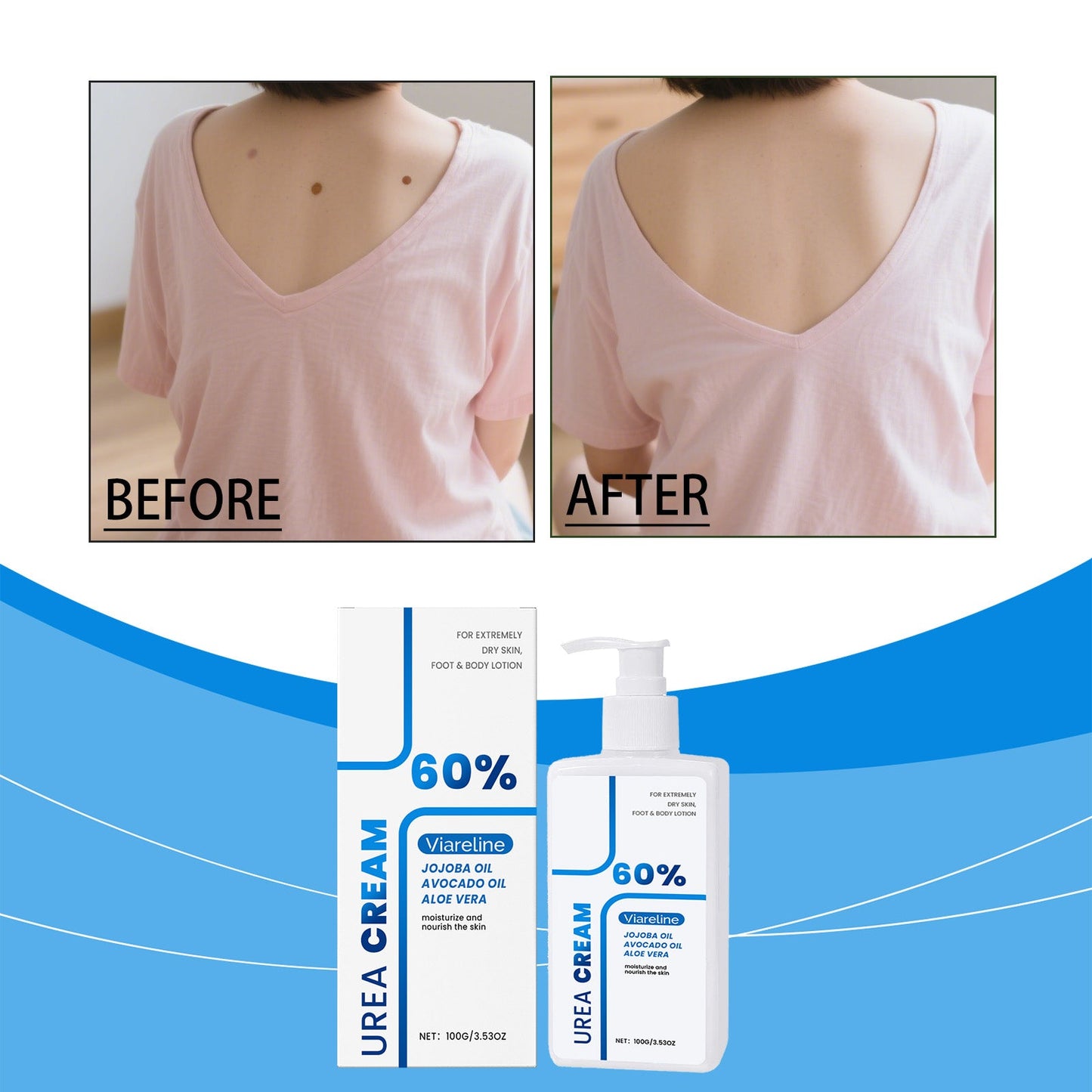 Urea body lotion held in hand for size reference