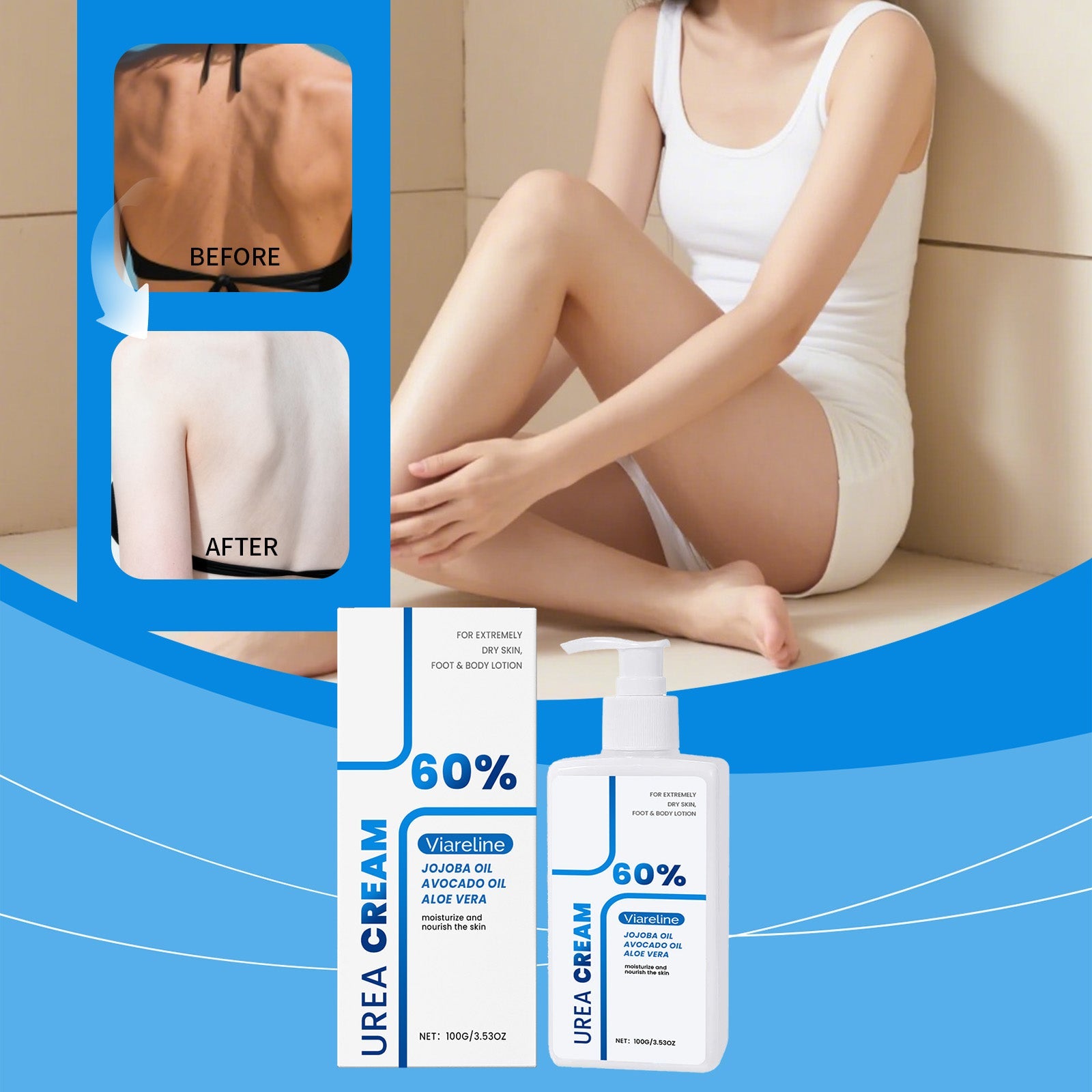 Before and after using urea body lotion on dry skin